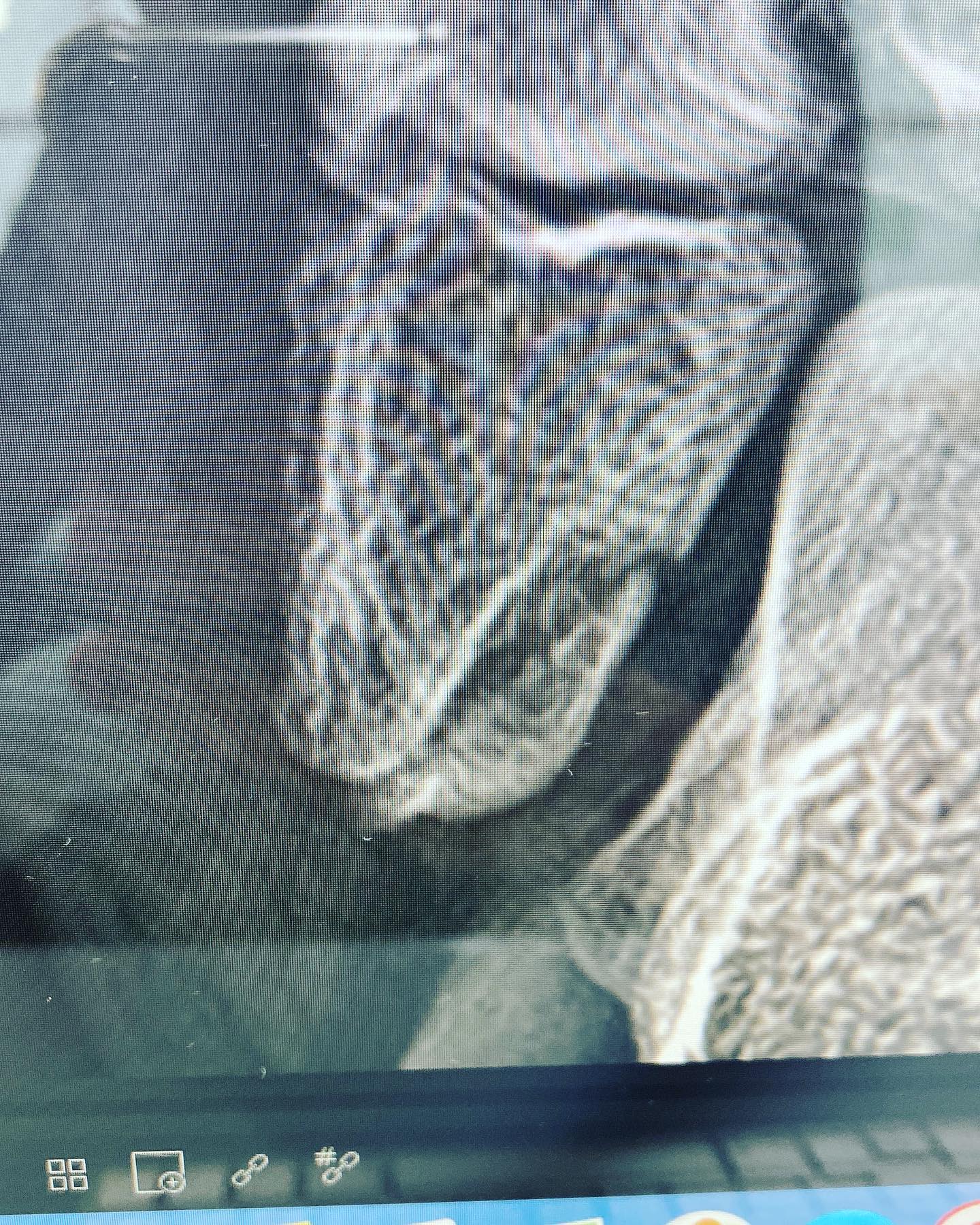 fractura de tobillito 2