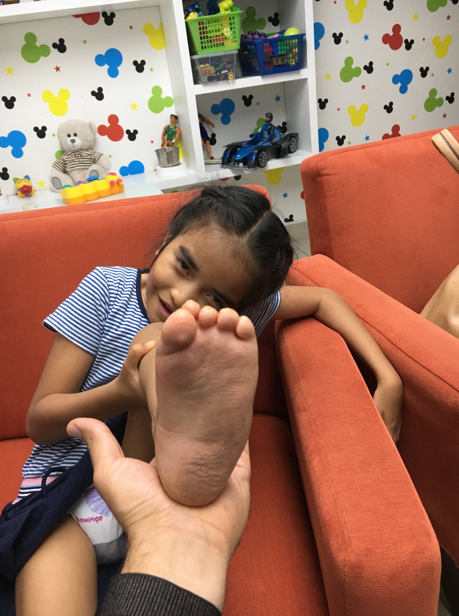 Enfermedad neurológica deformidad en pies 4